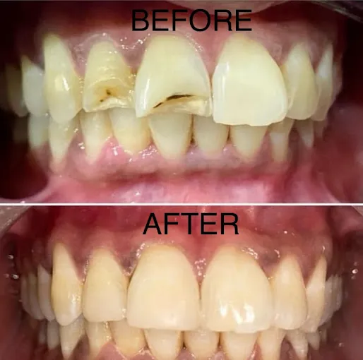 Image of: Rbs Dental Clinic In Madhavaram 3
