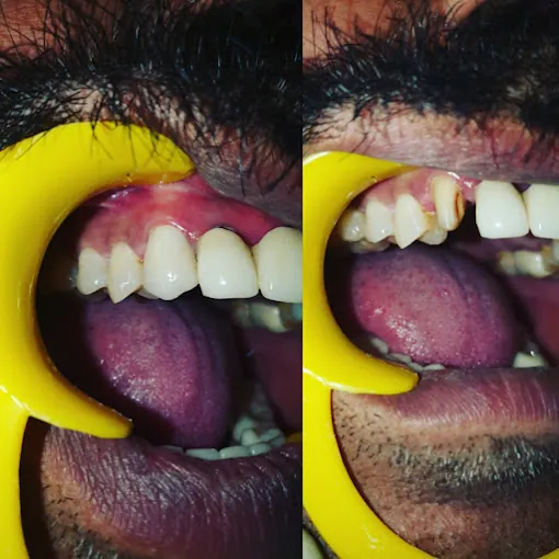 Image of: Right Smile Dental And Cosmetic In Chennai 2