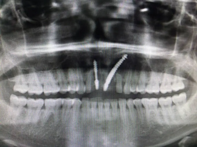Image of: Right Smile Dental And Cosmetic In Chennai 4