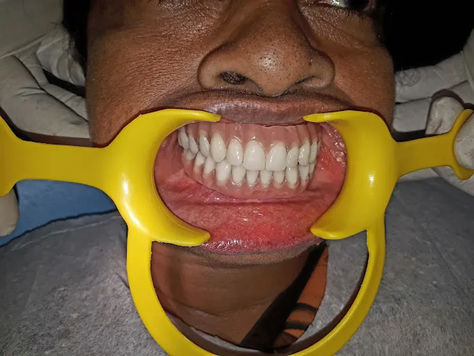 Image of: Right Smile Dental And Cosmetic In Chennai 5