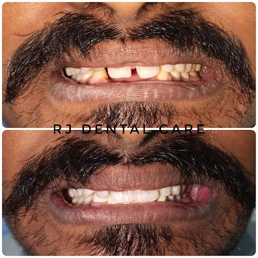 Image of: Rj Dental Care In Perambur 2