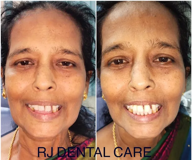 Image of: Rj Dental Care In Perambur 4