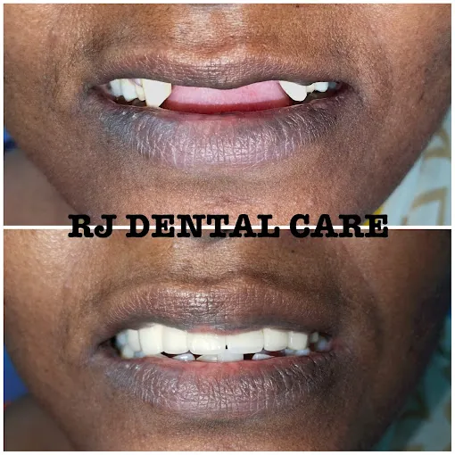 Image of: Rj Dental Care In Perambur 5