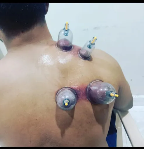 Image of: Rmj Physiotherapy And Acupuncture Clinic In Adyar 2