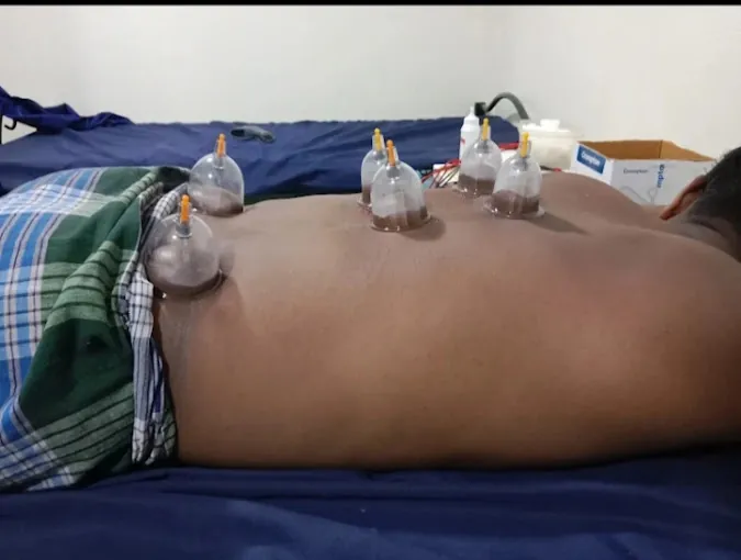 Image of: Rmj Physiotherapy And Acupuncture Clinic In Adyar 6