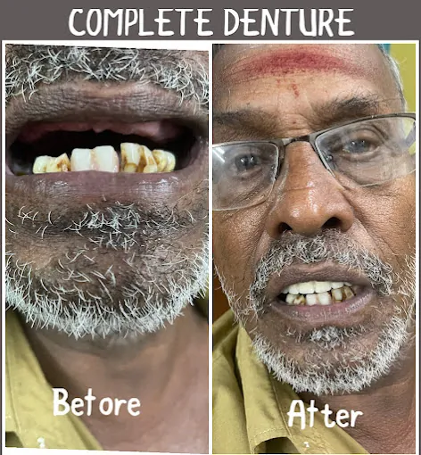 Image of: Roots Dental Clinic In Vyasarpadi