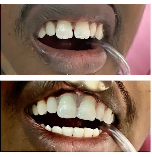 Image of: Roots Dental Clinic In Vyasarpadi 3