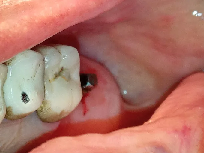 Image of: Rr Multispeciality Dental Clinics In Thiruvanmiyur 2