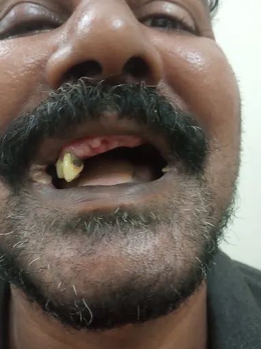Image of: Rr Multispeciality Dental Clinics In Thiruvanmiyur