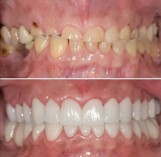 Image of: Sakthi Dental Clinic In Saidapet 2