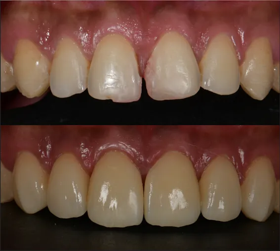 Image of: Sakthi Dental Clinic In Saidapet 3