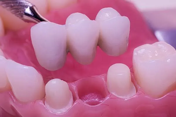 Image of: Saras Dental Clinic In Perambur 2