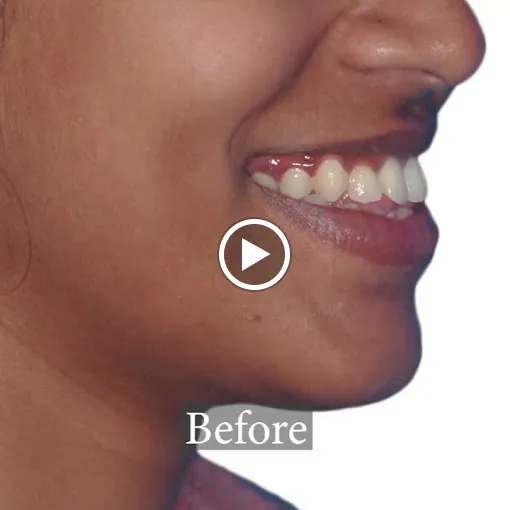 Image of: Sculpt Dental Studio In Nandanam 6