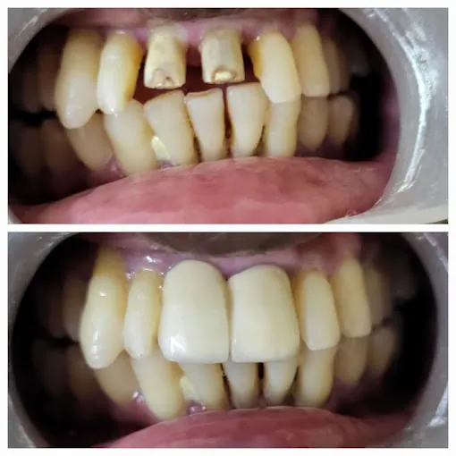 Image of: Shalom Dental Clinic In Vyasarpadi