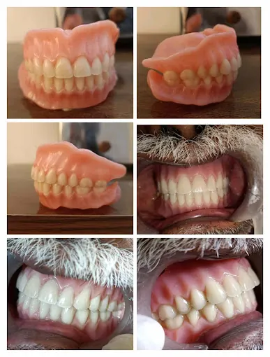Image of: Shalom Dental Clinic In Vyasarpadi 3