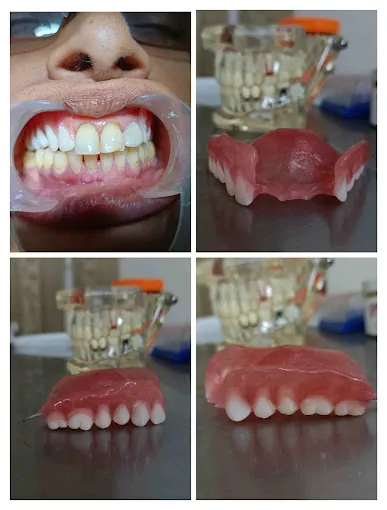 Image of: Shalom Dental Clinic In Vyasarpadi