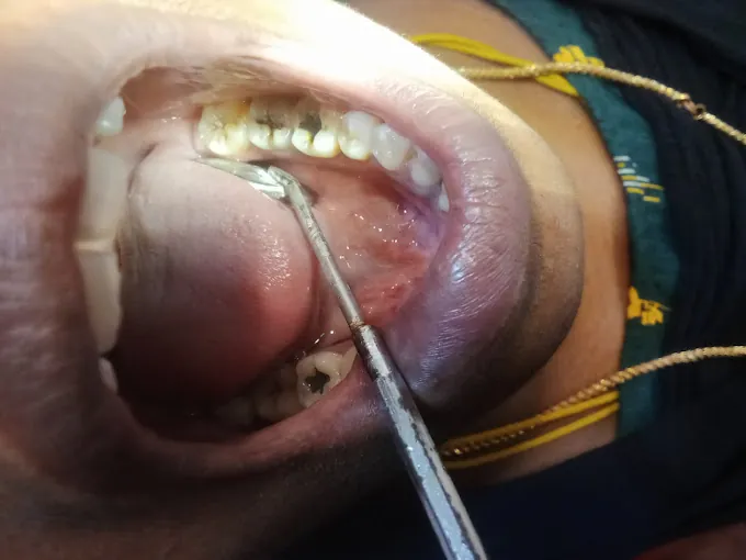 Image of: Shana Dental Care In Aminjikarai