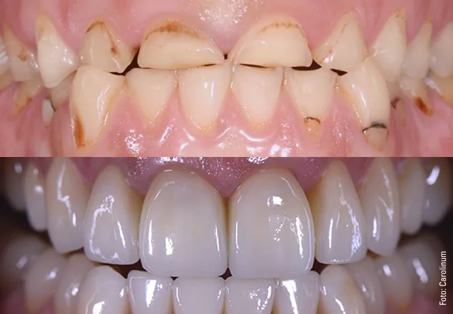 Image of: Shanthi Dental Care In Triplicane
