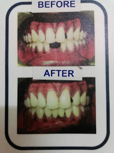 Image of: Shifa Dental Multispeciality Clinic In Chennai