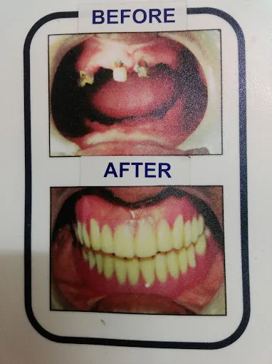 Image of: Shifa Dental Multispeciality Clinic In Chennai 2