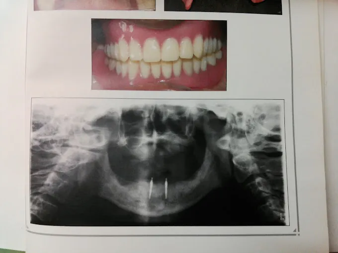 Image of: Shifa Dental Multispeciality Clinic In Chennai 3