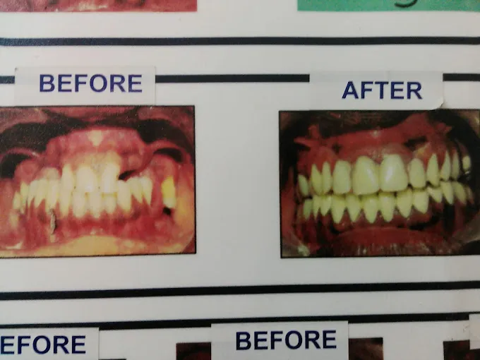 Image of: Shifa Dental Multispeciality Clinic In Chennai