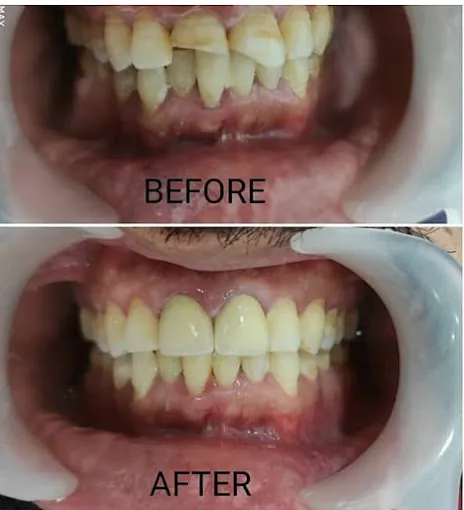 Image of: Shree Dental Clinic In Porur