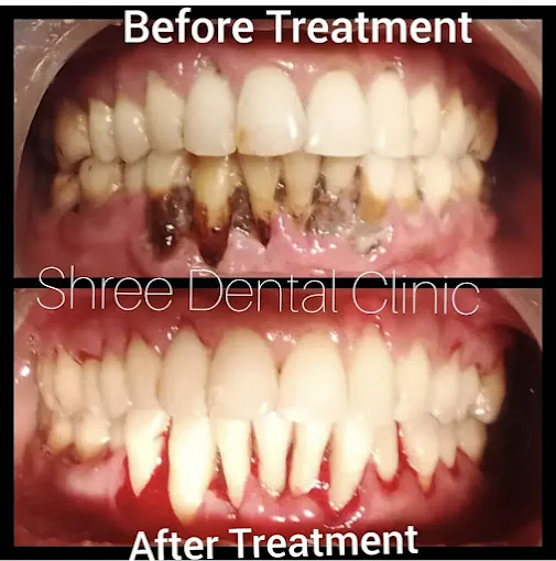 Image of: Shree Dental Clinic In Porur