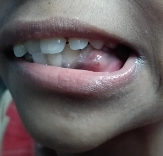Image of: Smile Arc Dental Care In Teynampet