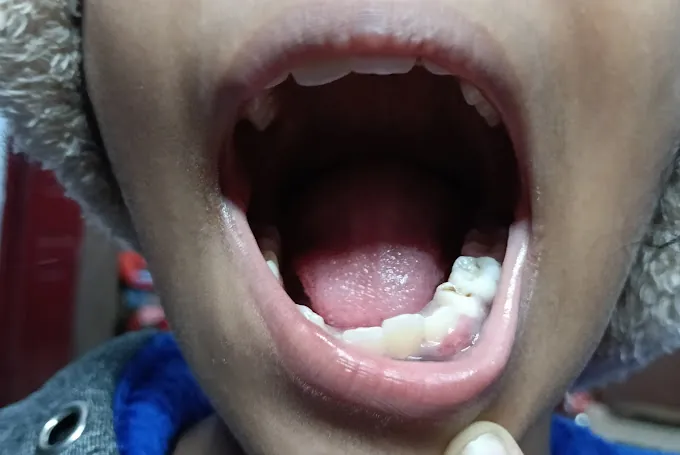 Image of: Smile Arc Dental Care In Teynampet 3