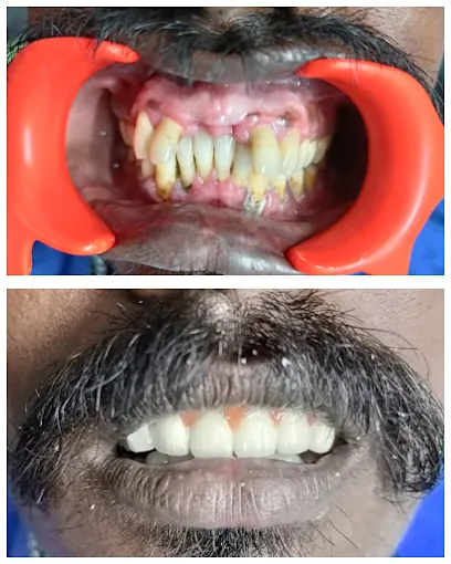 Image of: Smile Boss Dental And Face In Saidapet 2