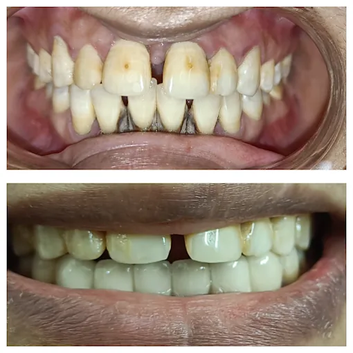 Image of: Smile Boss Dental And Face In Saidapet 3