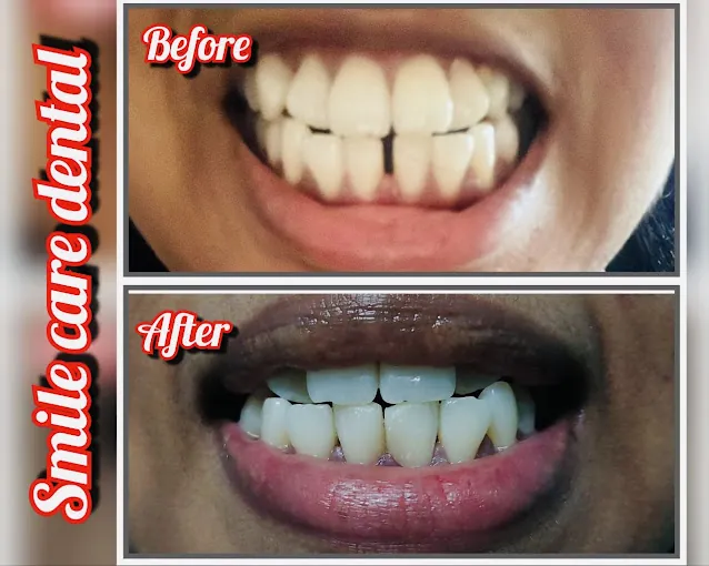 Image of: Smile Care Dental In Ambattur