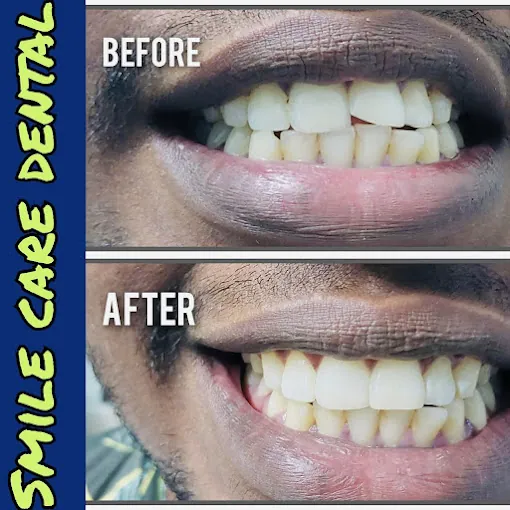 Image of: Smile Care Dental In Ambattur 3