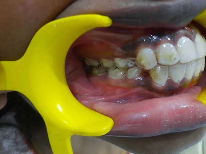 Image of: Smile Designs Dental Clinic In Virugambakkam 2