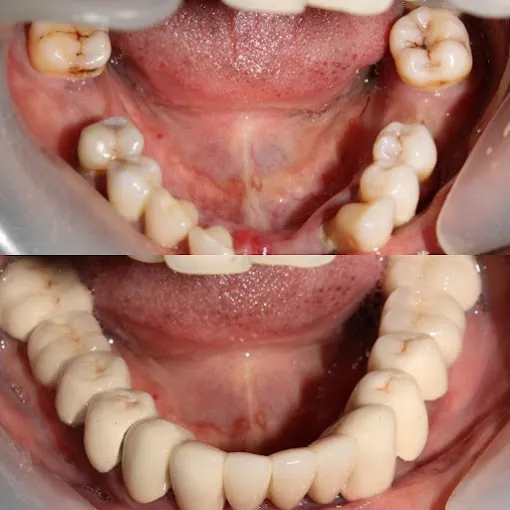 Image of: Smile Line Dental Clinic In Perambur