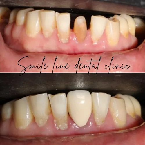 Image of: Smile Line Dental Clinic In Perambur 5