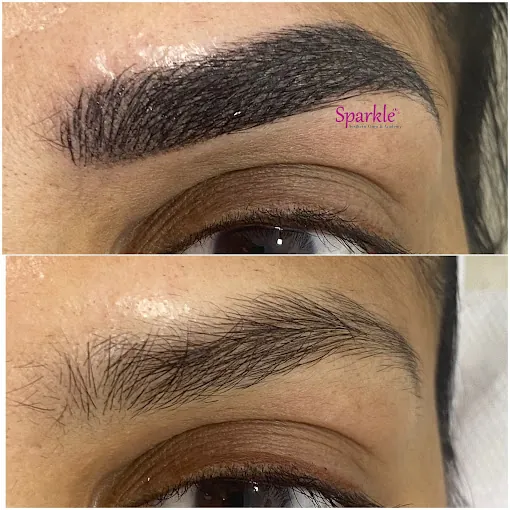 Image of: Sparkle Aesthetic Clinic In Saligramam
