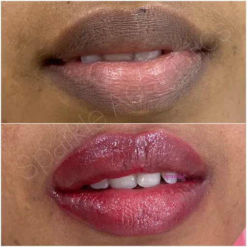 Image of: Sparkle Aesthetic Clinic In Saligramam 2