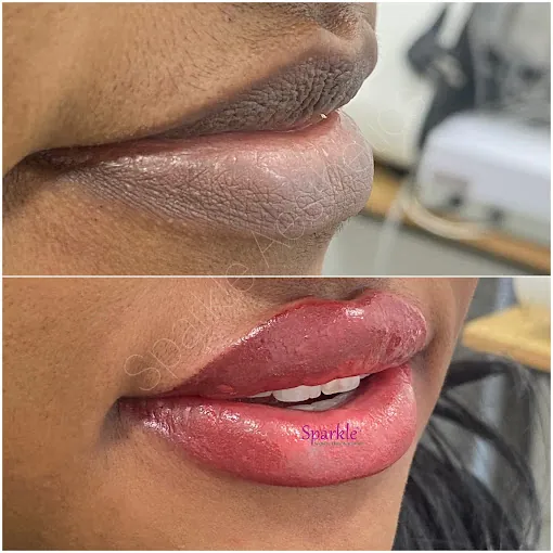 Image of: Sparkle Aesthetic Clinic In Saligramam 3