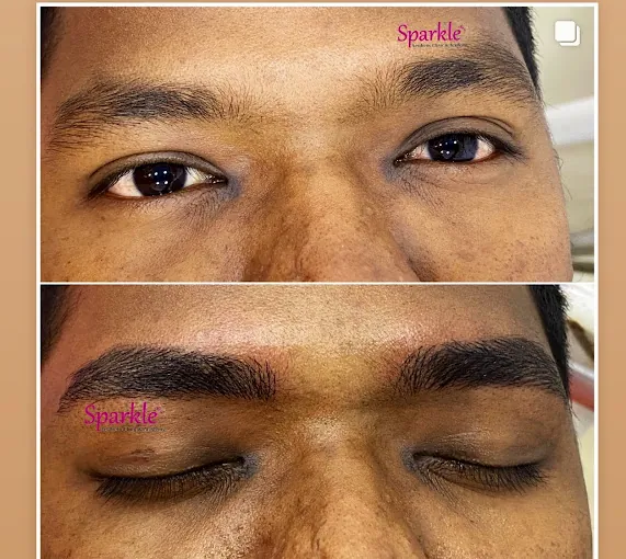 Image of: Sparkle Aesthetic Clinic In Saligramam 6