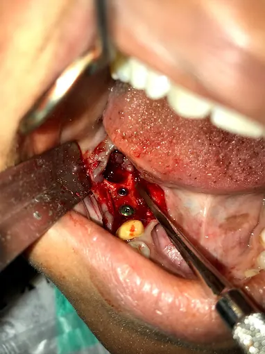 Image of: Sri Danvantari Dental Care In Saligramam 2