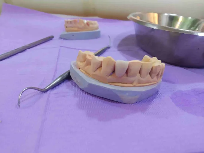 Image of: Sri Ganesh Dental And Implant In Tondiarpet 3