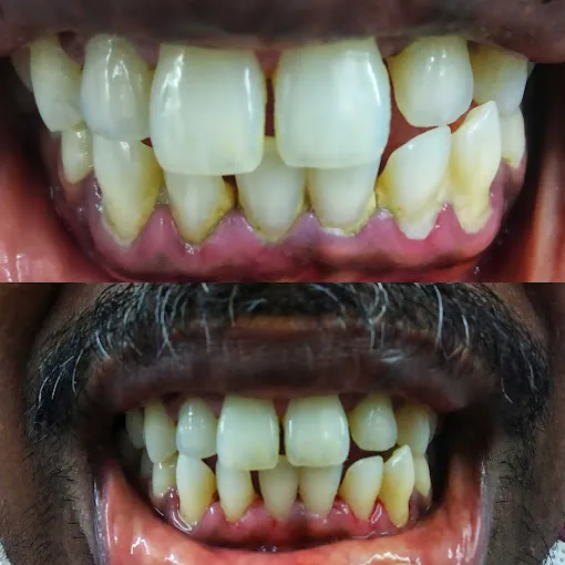 Image of: Sri Ganesh Dental And Implant In Tondiarpet