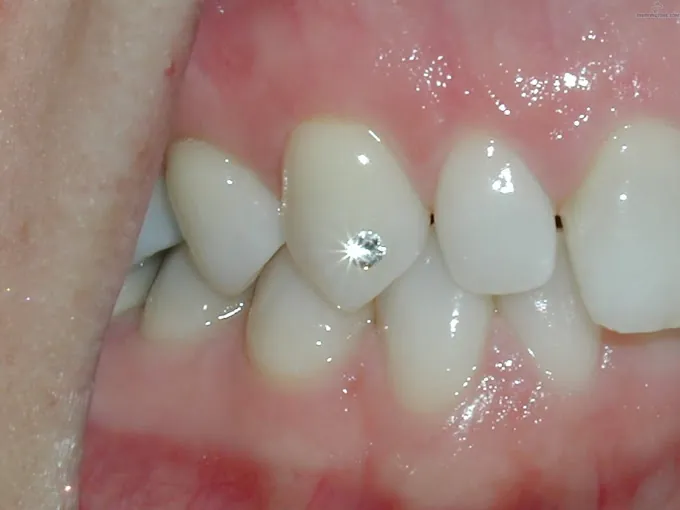 Image of: Supreme Multi Speciality Dental Centre In Kodambakkam 3