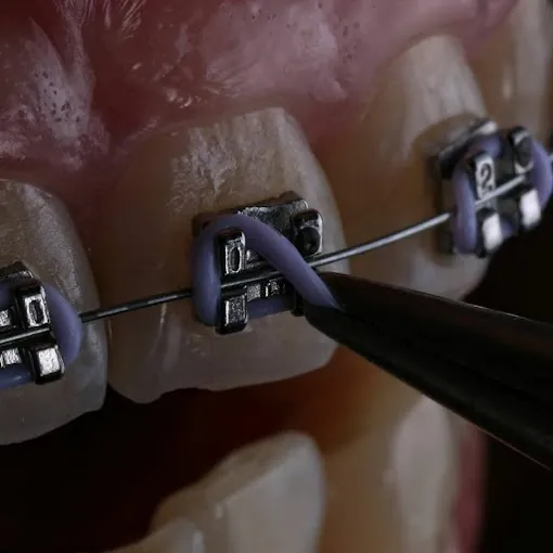 Image of: Thamara Dental Clinic In Chennai 2