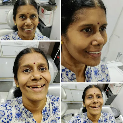 Image of: Thilagavathis Dental Care In Saidapet