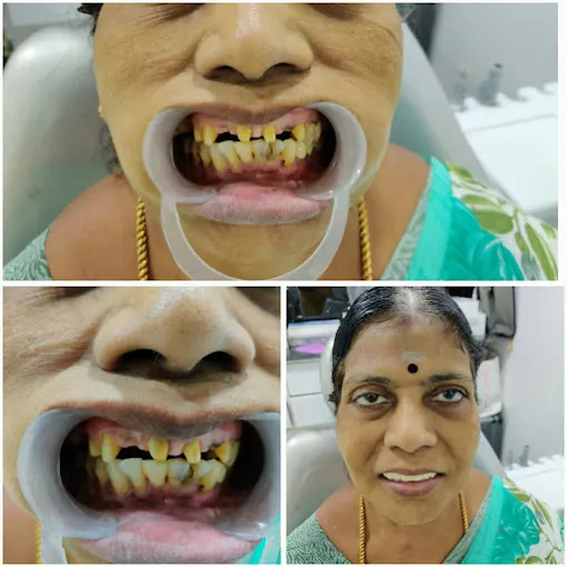 Image of: Thilagavathis Dental Care In Saidapet