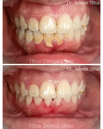 Image of: Titus Dental Clinic In Kodambakkam 3