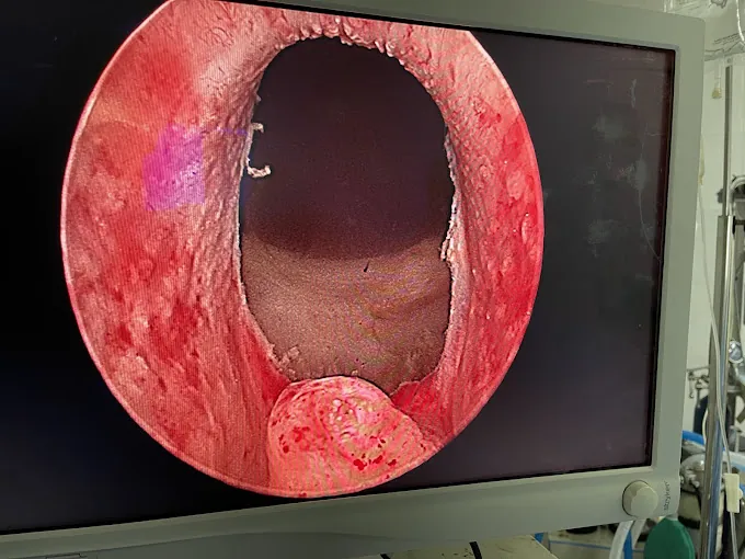Image of: Urocare Kidney Stone And Urologist In Tambaram